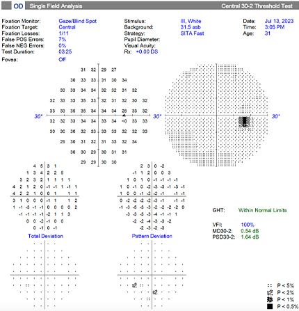 visual field testing