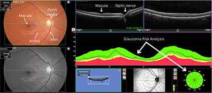 retinal imaging